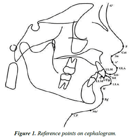 clinical-dentistry-trials-cephalogram