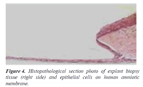 clinical-epithelial