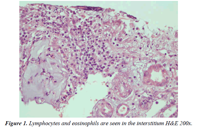 clinical-nephrology-therapeutics-lymphocytes-eosinophils