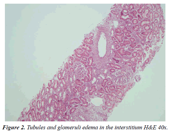 clinical-nephrology-therapeutics-lymphocytes-eosinophils