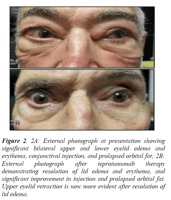 clinical-ophthalmology-lower