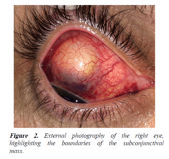 clinical-ophthalmology-photography