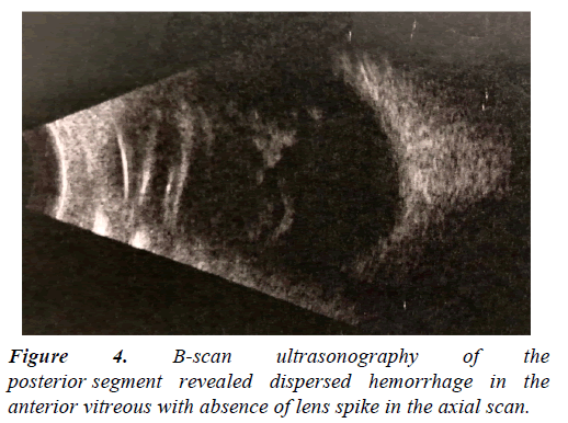 clinical-ophthalmology-ultrasonography