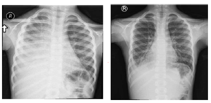 current-pediatric-images