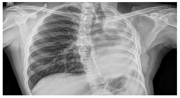 current-pediatrics-chest