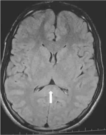 current-pediatrics-rickettsial