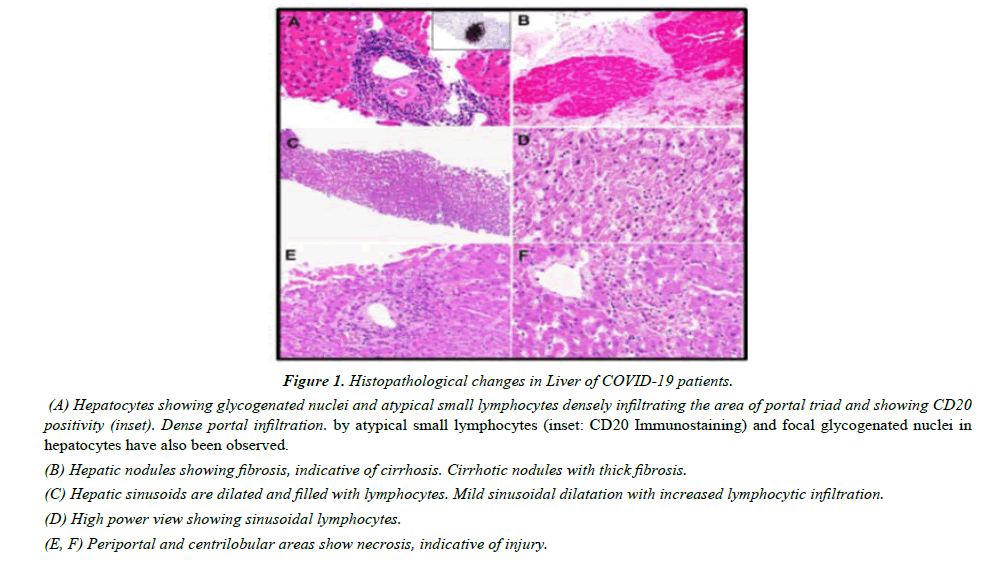 pathology-biology-Histopathological