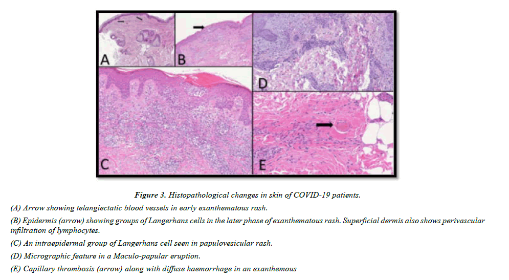 pathology-biology-exanthematous