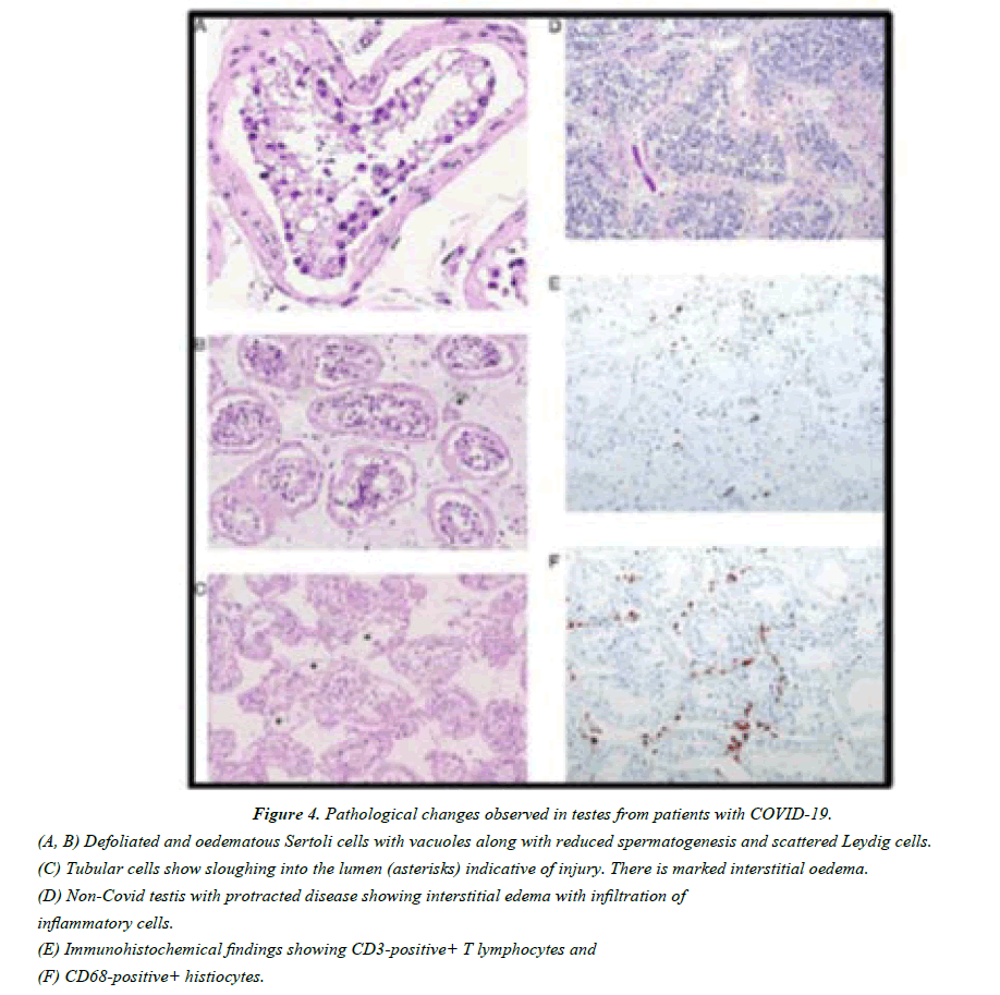 pathology-biology-lymphocytes