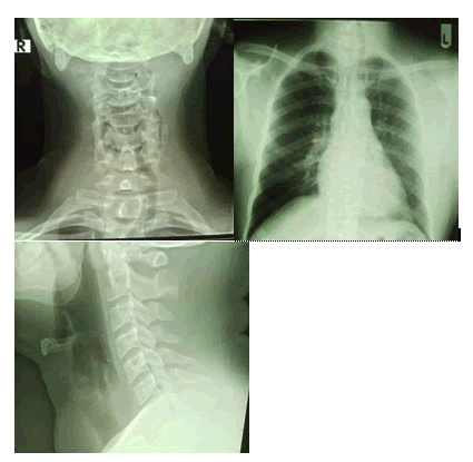 surgery-invasive-procedures