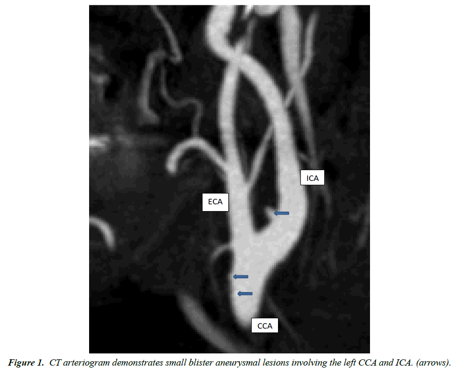 trauma-and-critical-care-arteriogram-demonstrates