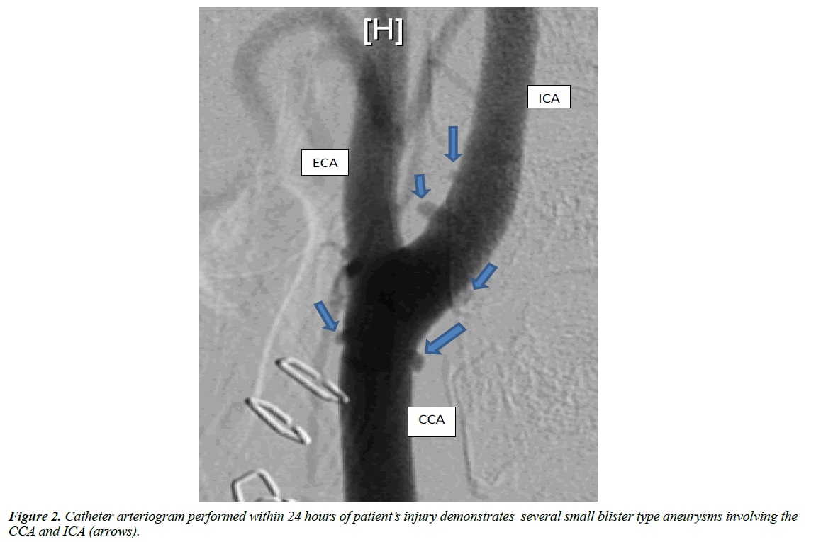 trauma-and-critical-care-arteriogram-demonstrates