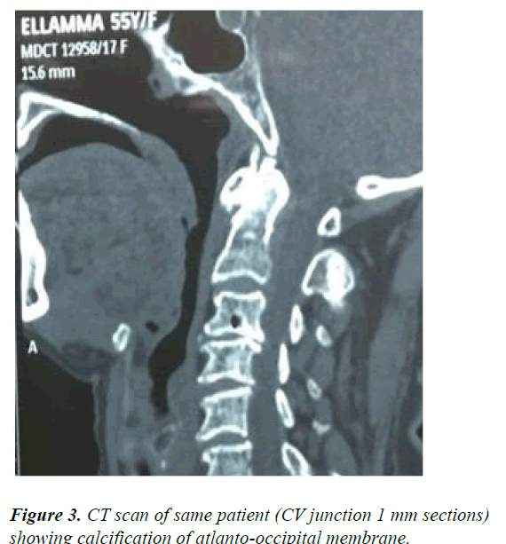 AAOSR-CT