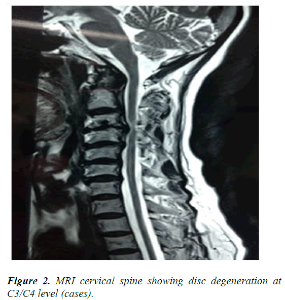 AAOSR-MRI