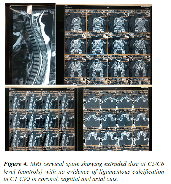 AAOSR-cervical