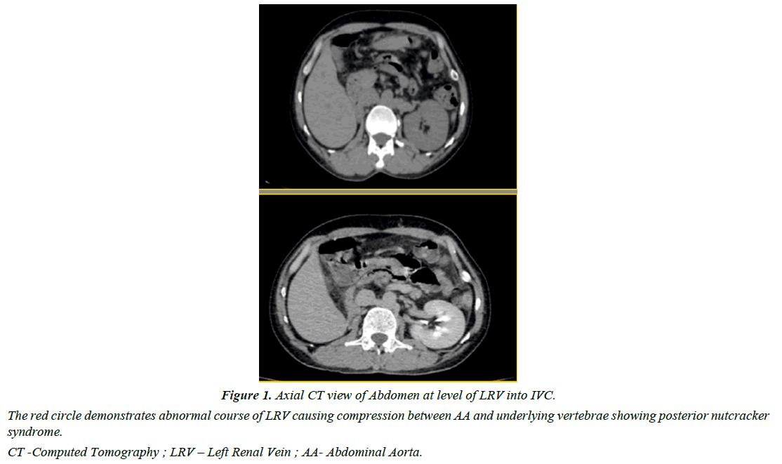 archives-general-internal-medicine-axial-ct-view