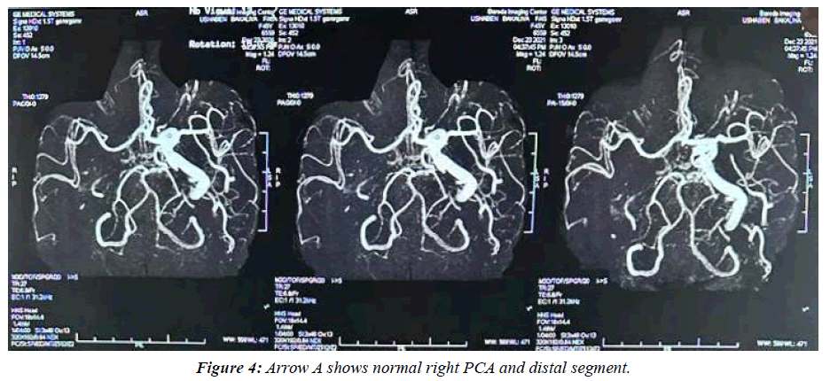 archives-general-internal-medicine-fronto-parietal-involvement