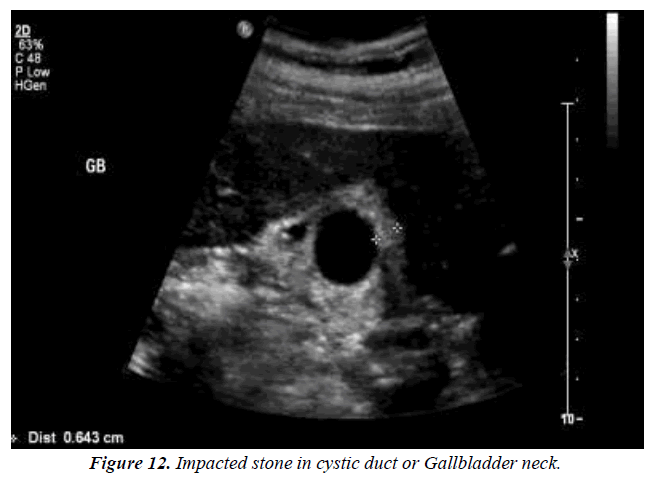 archives-general-internal-medicine-gallbladder-wall-thickness