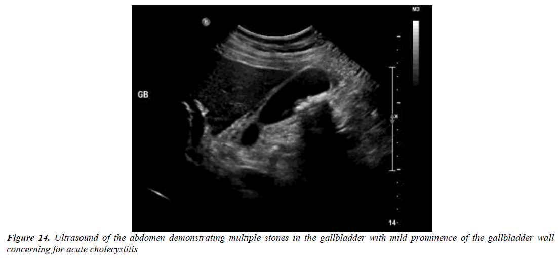 archives-general-internal-medicine-gallbladder-wall-thickness