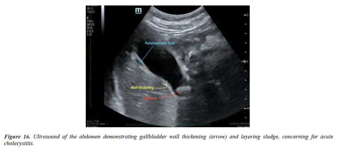 archives-general-internal-medicine-gallbladder-wall-thickness