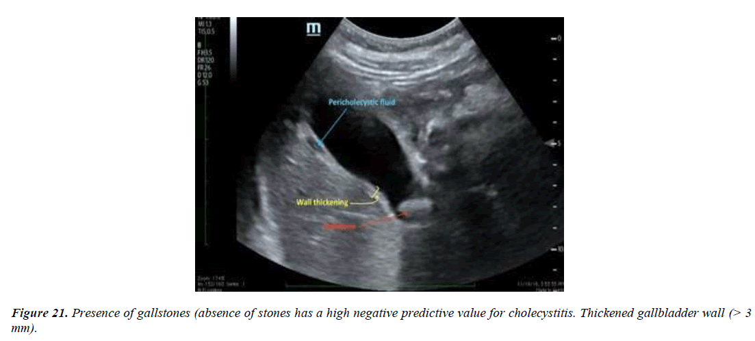 archives-general-internal-medicine-gallbladder-wall-thickness