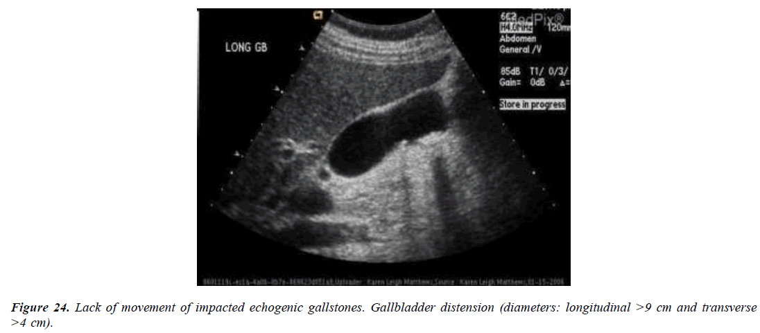 archives-general-internal-medicine-gallbladder-wall-thickness