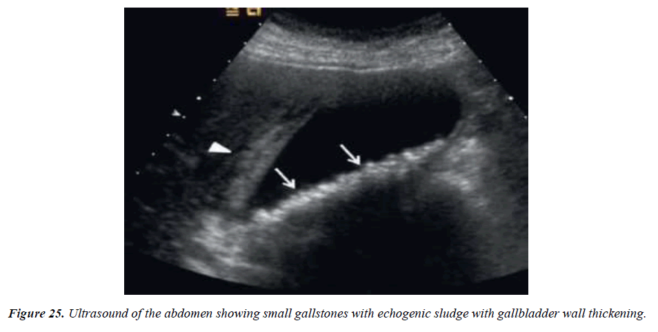 archives-general-internal-medicine-gallbladder-wall-thickness