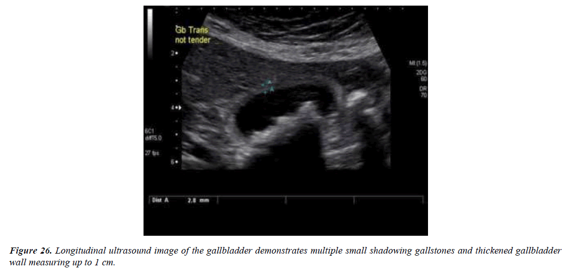 archives-general-internal-medicine-gallbladder-wall-thickness