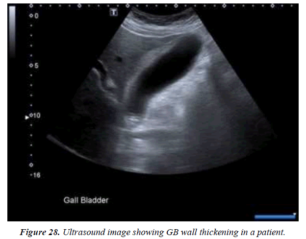 archives-general-internal-medicine-gallbladder-wall-thickness