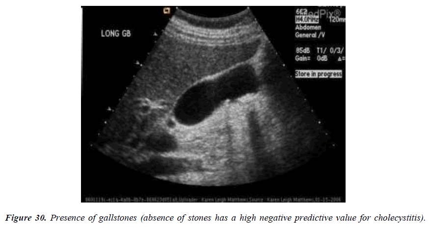 archives-general-internal-medicine-gallbladder-wall-thickness