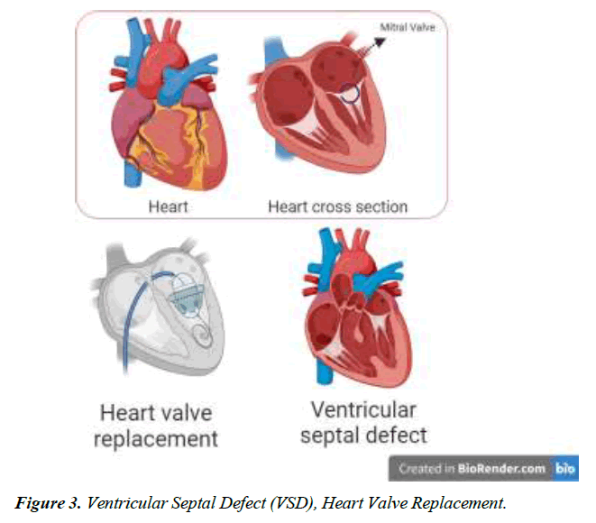 archives-of-general-internal-medicine-mitral-valve-regurgitation