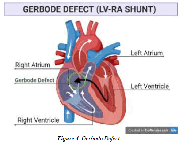 archives-of-general-internal-medicine-mitral-valve-regurgitation