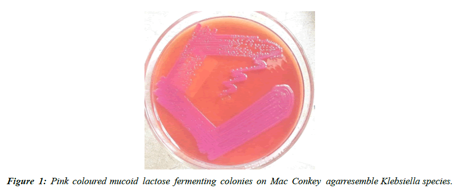 asian-biomedical-mucoid-lactose-fermenting