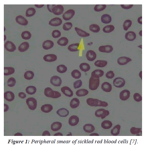 biochemistry-biotechnology-blood-cells