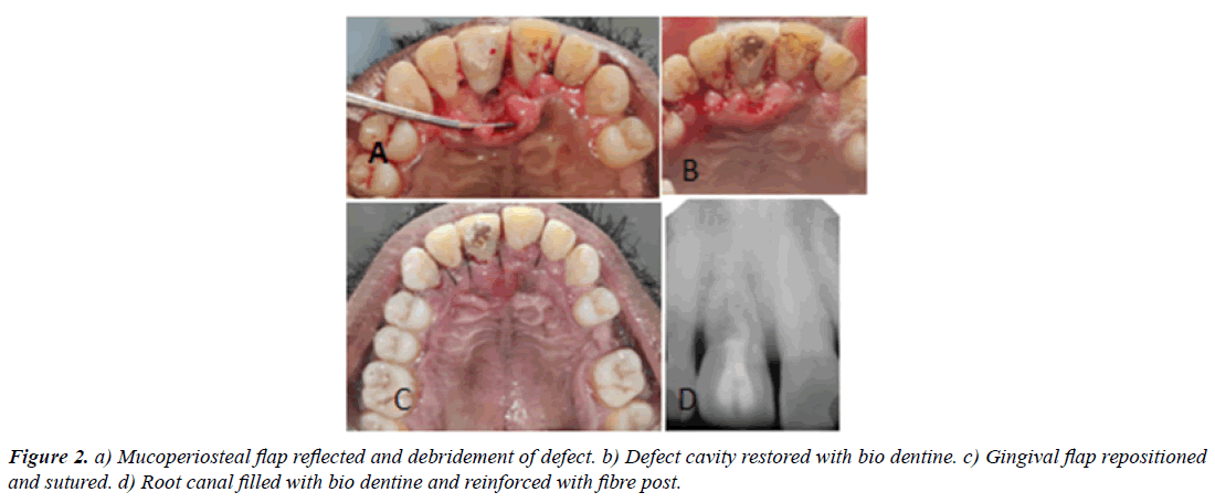 clinical-dentistry-central-incisor
