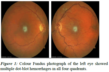 clinical-ophthalmology-blot