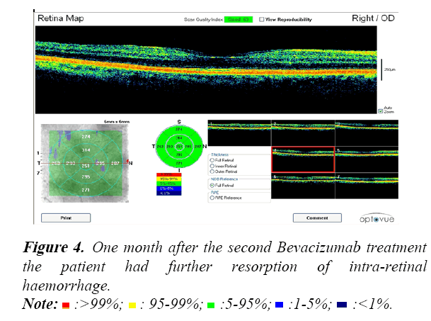 linical-ophthalmology-intra