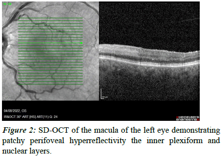 clinical-ophthalmology-patchy