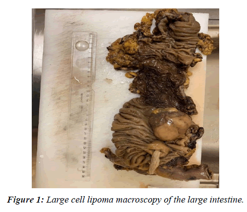 clinical-pathology-laboratory-medicine-large-intestine