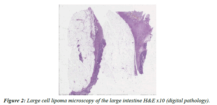 clinical-pathology-laboratory-medicine-large-intestine