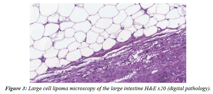 clinical-pathology-laboratory-medicine-large-intestine