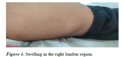 clinical-pediatrics-thigh
