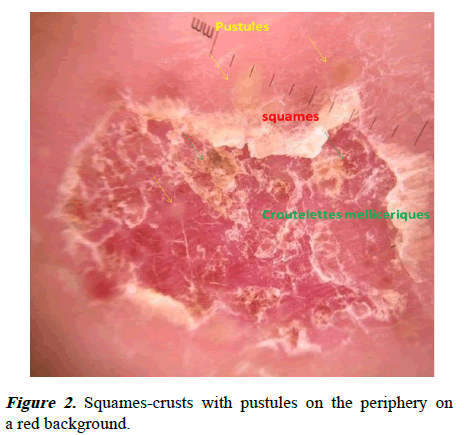 current-pediatric-red