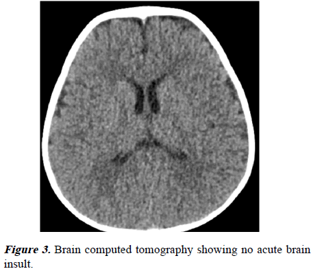 current-pediatrics-brain