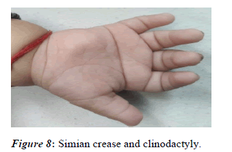 current-pediatrics-crease