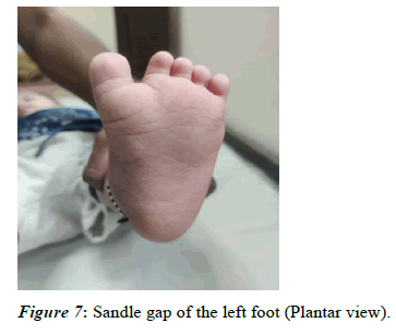 current-pediatrics-foot
