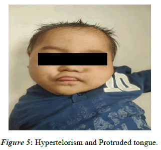 current-pediatrics-hyper