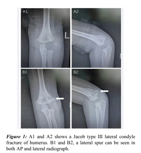 radiograph