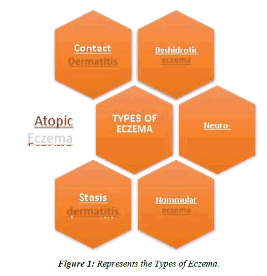 dermatology-research-skin-care-types-of-eczema