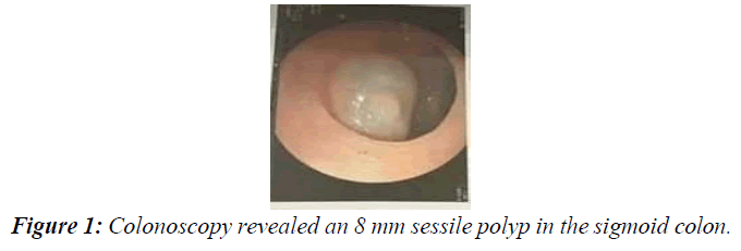 gastroenterology-digestive-diseases-sigmoid-colon